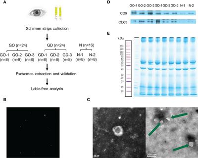 Tear-derived exosomal biomarkers of Graves’ ophthalmopathy